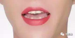 牙齿发黄是不是因为营养不良,牙齿黄被人嫌弃