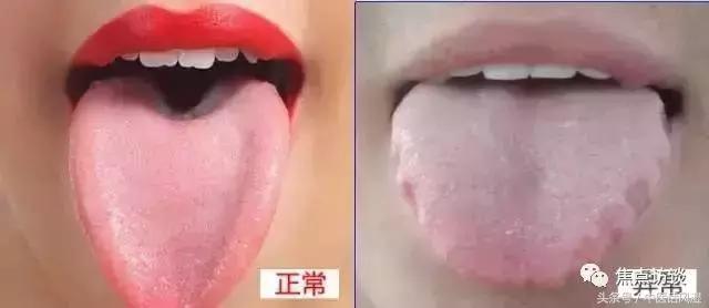 排出身体里的湿气真的能瘦吗,吐纳呼吸七天排出十年湿气