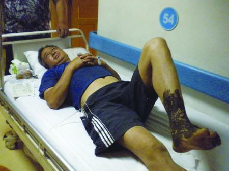 蛇毒急救,中蛇毒正确急救方法是什么