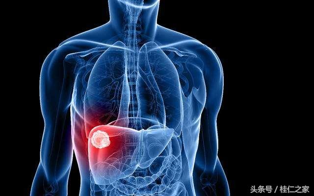 肝炎危害有多可怕,传染性肝炎如何有效的预防