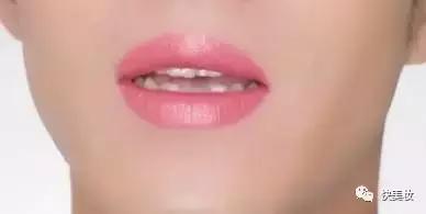 牙齿发黄是不是因为营养不良,牙齿黄被人嫌弃