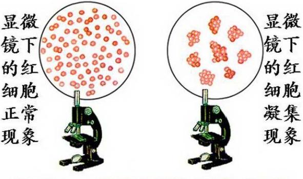 什么血型跟什么血型会是什么血型,血型是什么时候开始发现的