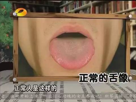 舌头是隐藏黑暗力量的钥匙，把舌头伸出来，跟着ZK叔学中医~
