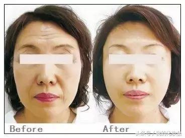 所以说你们想要的“少女颜”是怎么养成的呢？