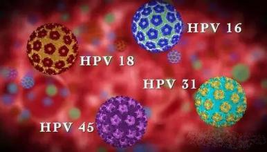 容易导致宫颈癌的hpv型号,妇科宫颈癌筛查和hpv检查费用多少