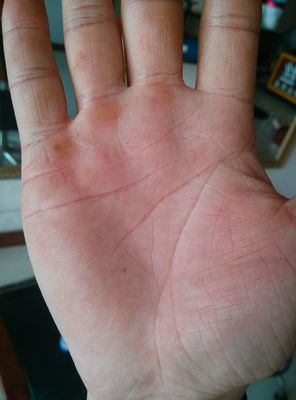 姻缘线断了有什么后果,婚姻线分叉怎么看几段姻缘