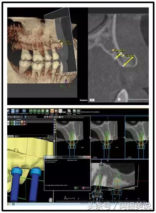 98%的人嘴里都有一颗“定时*弹炸**”，看看你中招了吗？