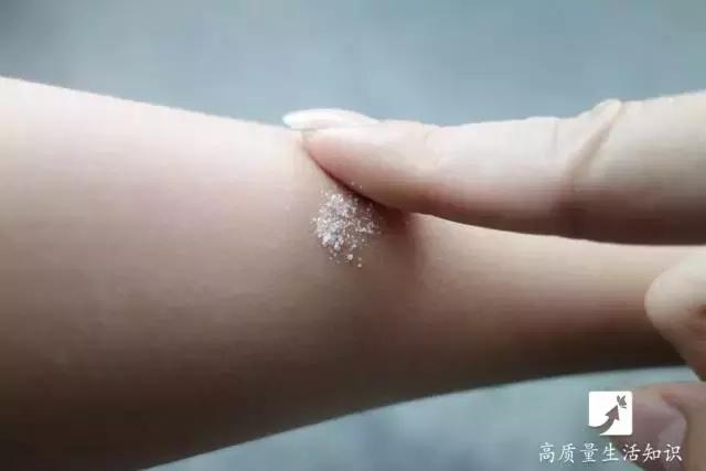 蚊子咬后奇痒快速止痒,蚊子叮了怎么能快速止痒