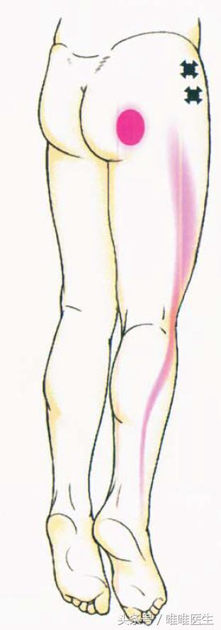 绝对干货膝盖损伤知识一网打尽,膝关节疼痛知识科普