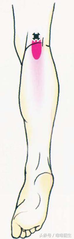 绝对干货膝盖损伤知识一网打尽,膝关节疼痛知识科普