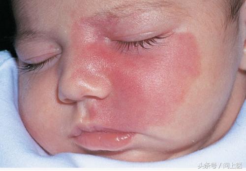 胎记原来是这样来的,你有胎记吗什么意思