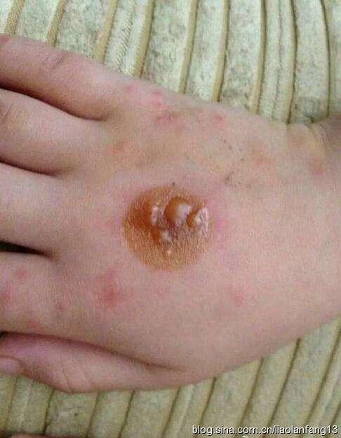 艾艾贴暖颈贴,艾艾贴正品多少钱一盒