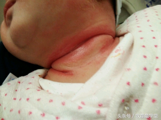 产妇给婴儿哺乳就恶心咋回事,产妇喂孩子的时候感觉恶心