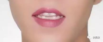 牙齿发黄是不是因为营养不良,牙齿黄被人嫌弃