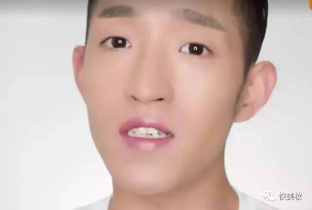 牙齿发黄是不是因为营养不良,牙齿黄被人嫌弃