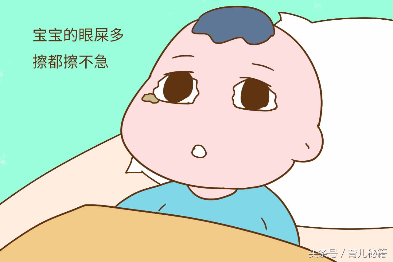 宝宝眼屎过多妈妈们该怎么办,宝宝眼屎多是哺乳妈妈上火了吗