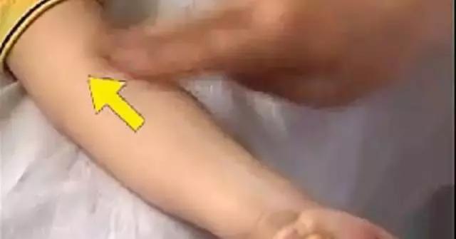 穴位埋线治湿疹多久才有效果,儿童湿疹的食疗