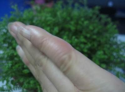 抗癌补血的民间药方,补血益气排毒抗衰