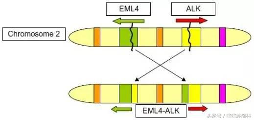 把恶性肿瘤治好相当于什么,把癌症变成慢性病的方法