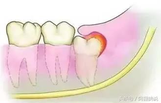 98%的人嘴里都有一颗“定时*弹炸**”，看看你中招了吗？