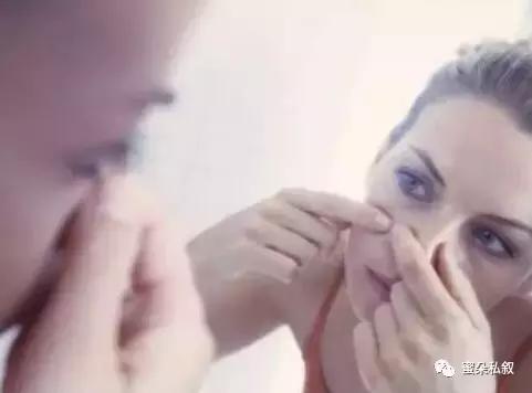 那些让你相见恨晚的神器,祛痘神器针对5年痘痘