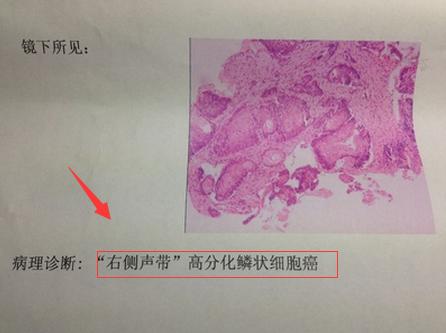 白癜风病人的问题,白癜风总有新的白斑出现怎么办