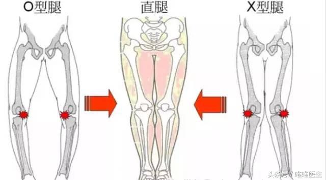 绝对干货膝盖损伤知识一网打尽,膝关节疼痛知识科普