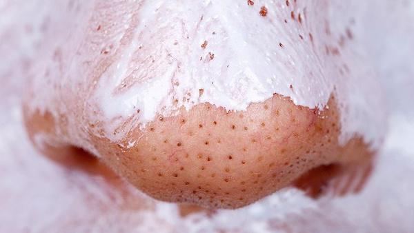 收毛孔去黑头的有效的方法,收毛孔去黑头的有效的小妙招