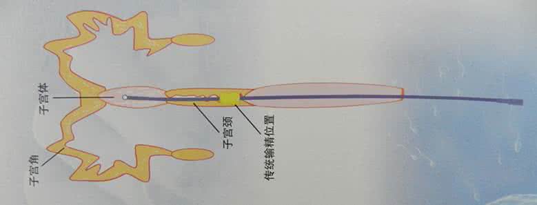后备母猪深部输精的危害,母猪深部输精后出血