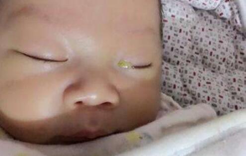 宝宝眼屎多能用纸巾擦吗,宝宝眼屎多吃清火宝可以吗
