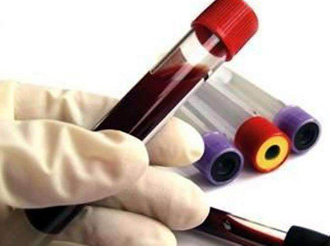 孩子血脂太高有什么风险,小孩血脂高怎么办