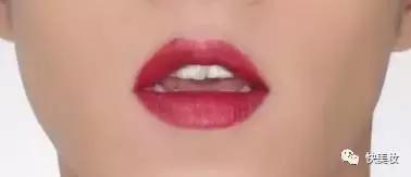 牙齿发黄是不是因为营养不良,牙齿黄被人嫌弃