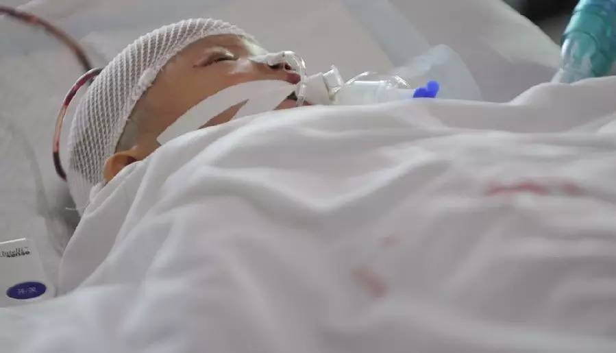 地震急救的基本方法,地震后如何正确急救