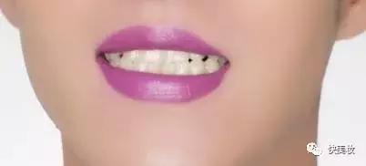 牙齿发黄是不是因为营养不良,牙齿黄被人嫌弃