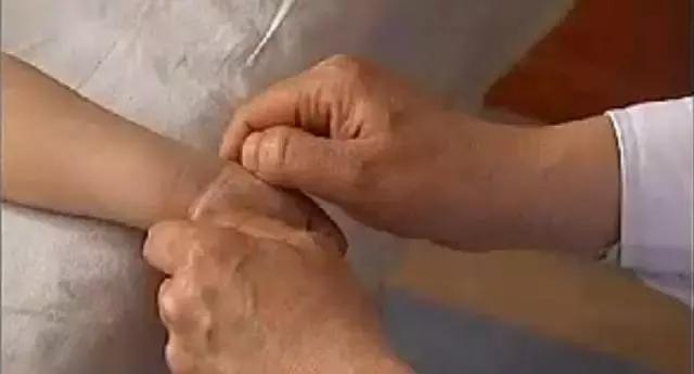 穴位埋线治湿疹多久才有效果,儿童湿疹的食疗