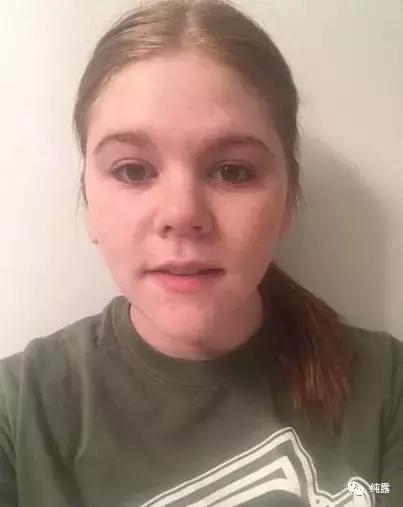 如何制定一个适合自己的纯露补水方案