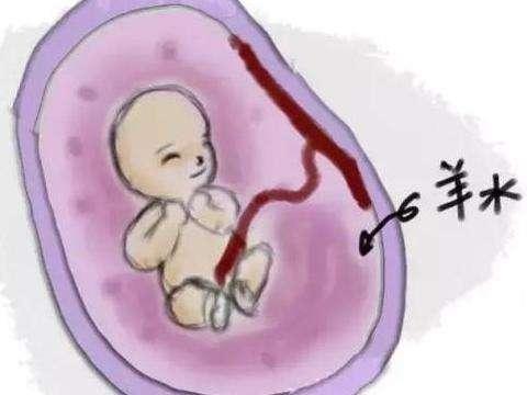 孕妈妈们羊水少怎么补才长的快,孕妈妈该如何预防羊水栓塞