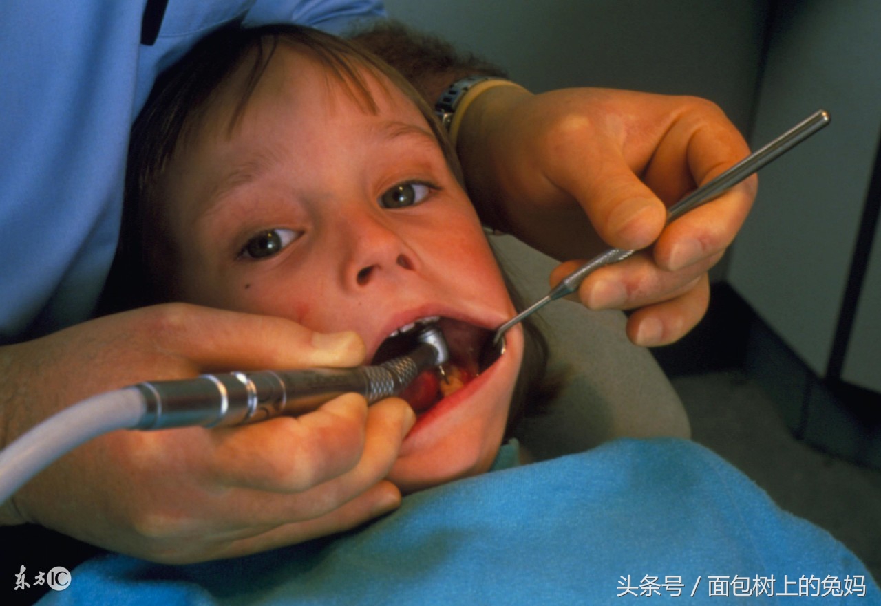 孩子在换牙之前烂牙需要处理吗,2岁小孩牙坏掉