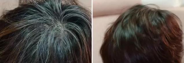 不沾头皮的染发膏,头发白了怎样染黑不用染发膏