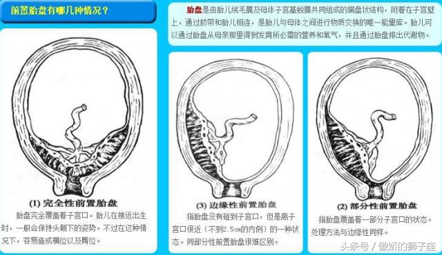 准妈妈必须小心保健误区,准妈妈孕期禁忌