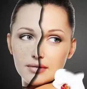 孕期长斑生完孩子后消失吗,孕期长斑怎么控制和消除