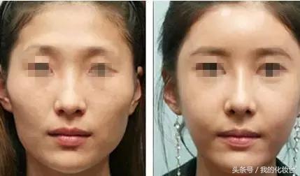 所以说你们想要的“少女颜”是怎么养成的呢？