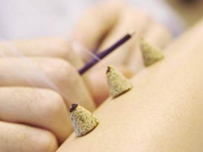 艾灸疗法的注意事项有哪些,艾灸疗法超有效