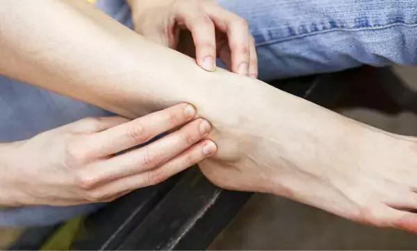 为啥有的人会水肿呢,如何判断自己是不是水肿体质