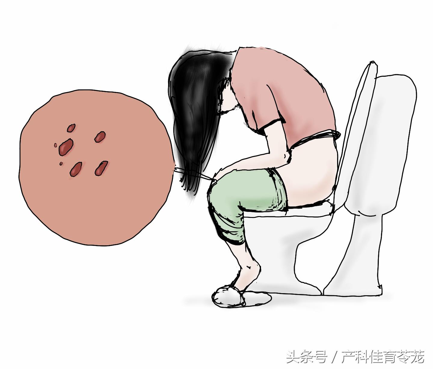 妊娠期感染hpv严重吗,妊娠期hpv