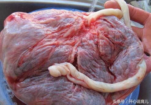 产后胎盘你们都怎么处置,胎盘你们怎么处置