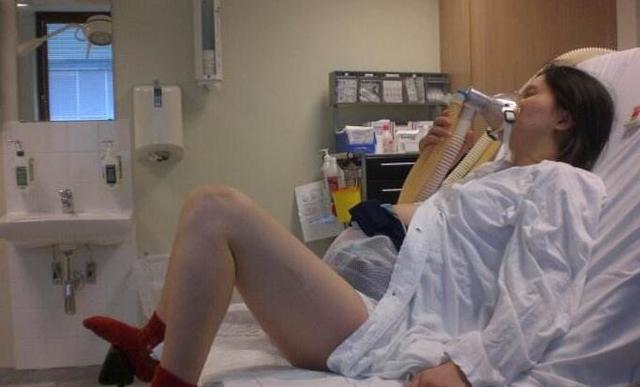 顺产什么情况下需要人工破水,顺产什么情况需要打催产素