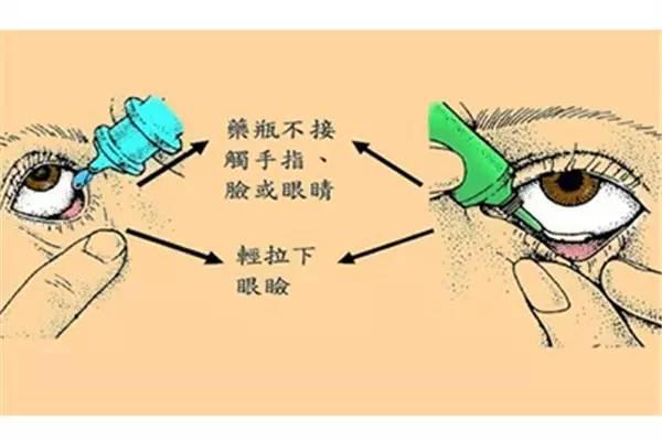 你还敢滥用眼药水吗,三岁小孩红眼病敢滴眼药水么