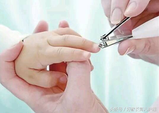 宝宝湿疹医生开什么药,宝宝湿疹怎么给宝妈解释