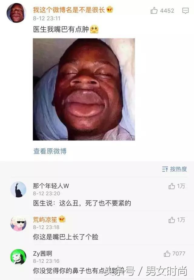 问医生嘴肿是怎么回事,医生嘴巴肿成了香肠嘴怎么回事